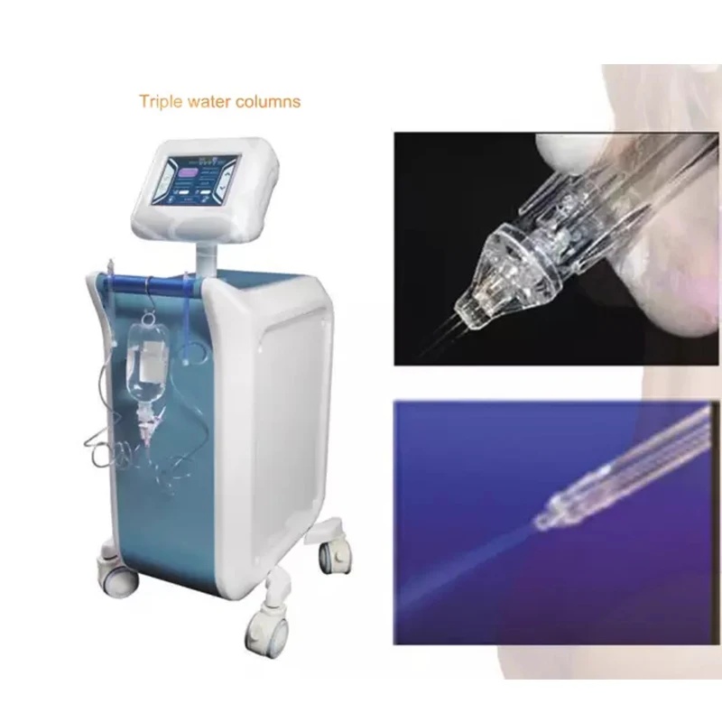 2025 Israel Tech vertical high - Jet Tech Accessories review and price